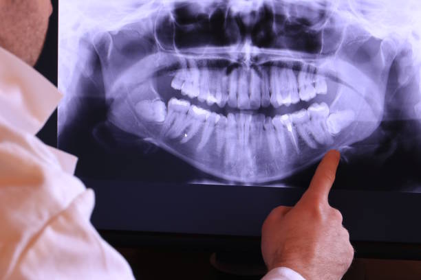 Best 24-Hour Emergency Dentist in Cobb Island, MD